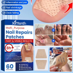 แผ่นซ่อมเล็บ แผ่นซ่อมเล็บแบบพกพา อ่อนโยน ฟื้นฟูเล็บ แผ่นซ่อมเล็บที่ยืดหยุ่น ช่วยฟื้นฟูเล็บที่เสียหาย