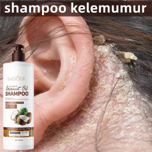 Sampo buat ketombe Shampoo Anti Dandruff Removes Dandruff Contains anti ketombe Coconut shampo Sampo anti gatal dan ketombe Sampo ketombe parah berkerak psoriasis Pembersihan lembut dan pengontrol minyak