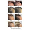 EXP 06/2026 HAIR GROWTH + inCLINIC BY NOURKRIN 90 TABLETS/ Hair Loss/Hair Restore 生发胶囊 90粒. 