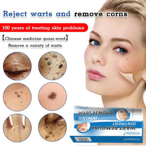 Face Wart Cream Cleansing Skin Care Flat Wart Wart Flat Wart Cream Remove Skin Warts and Corns