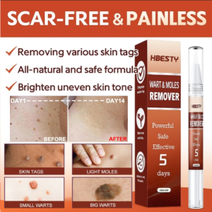 Plant Essence Wart Treatment Pen Moles Warts Remover Skin Tag Removal Ointment Cream 祛疣笔