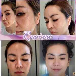 [1แถม1] คาร่า สกิน KARA Skin Serum เซรั่มลดฝ้ากระ จุดด่างดำ พร้อมส่ง