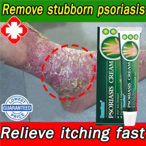 Kem bôi vẩy nến viêm da kháng khuẩn đánh bay nấm da chống ngứa viêm da hắc lào lang ben mề đay viêm da cơ địa á sừng vảy nến tổ đỉa viêm da dầu viêm da dị ứng