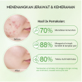 GLAD2GLOW - Real Mugwort Clay Mask Stick | Clay Mask | Masker Wajah. 