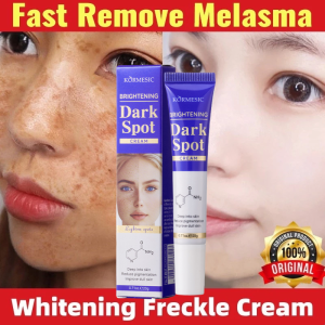 Kem nám tàn nhang chấm tàn nhang kem trắng da mặt 20g Loại bỏ nám tàn nhang làm trắng sáng da dưỡng ẩm da