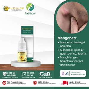 Obat Penghilang Benjolan Di Leher Obat Penghilang Benjolan di Tubuh  Obat Oles Penghilang Benjolan Lipoma Kelenjar Getah Bening - Propolis SM Brazil Asli Original 100%