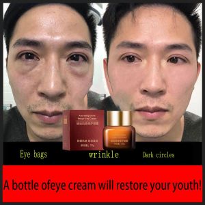 【Hàng Có Sẵn】kem Dưỡng Mắt Trị Thâm Quầng Mắt Chống Nhăn Loại Bỏ Túi Mắt Sửa Chữa Các Hạt Mỡ Krim Mata