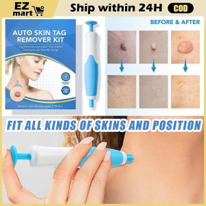 2-in-1 Auto Skin Tag Remover Painless Mole Wart Remover Skin Tag Removal Pen Wart Dot Corn Treatments Facial Beauty Tool