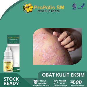 Propolis SM Solusi Eksim Kulit Gatal Psoriasis dan Kulit Kering Bersisik