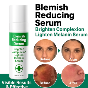 377 Whitening Essence Lightens melanin Blemish-removing essence Brightens skin tone Antioxidant to prevent dullness