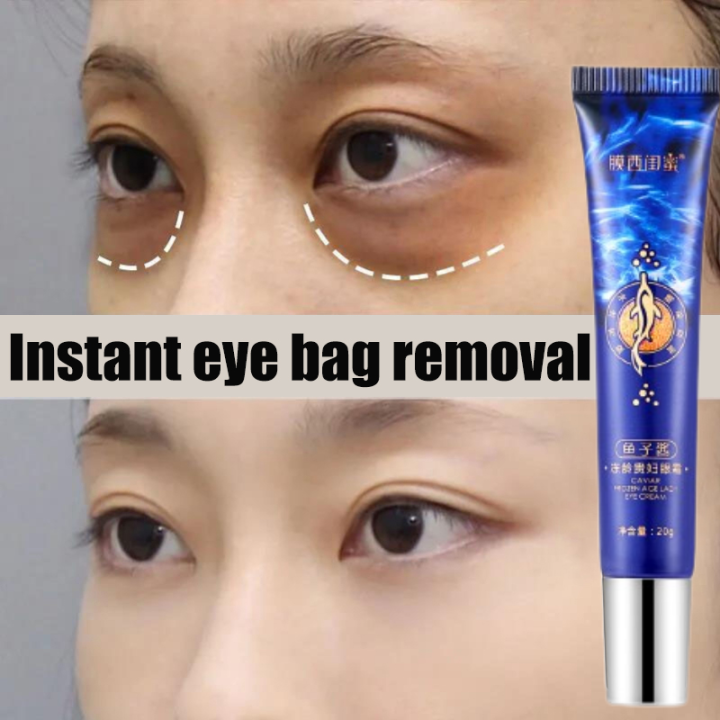 Caviar Eye Cream Original 20g Permanent Eyebag Wrinkles Remover