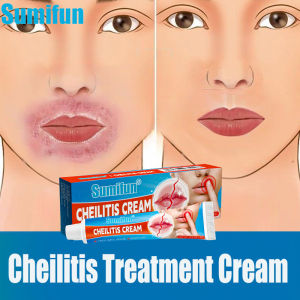 [Chính Hãng] Kem bôi môi hạt FORDYCE SUMIFUN dưỡng môi cải thiện môi thâm khô cứu tinh cho đôi môi hạt FORDYCE