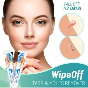 Face Wart Flat Wart Cream Chicken Eye Cream Flat Wart Kerb Cream