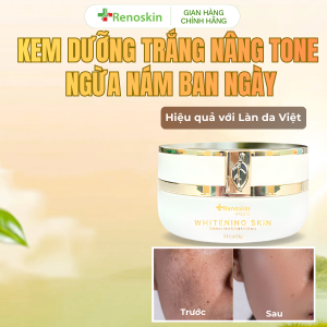Kem Dưỡng Trắng Ngừa Nám Whitening Skin 30g Renoskin Hỗ Trợ Dưỡng Ẩm Làm Sáng Da Giảm Thâm Nám