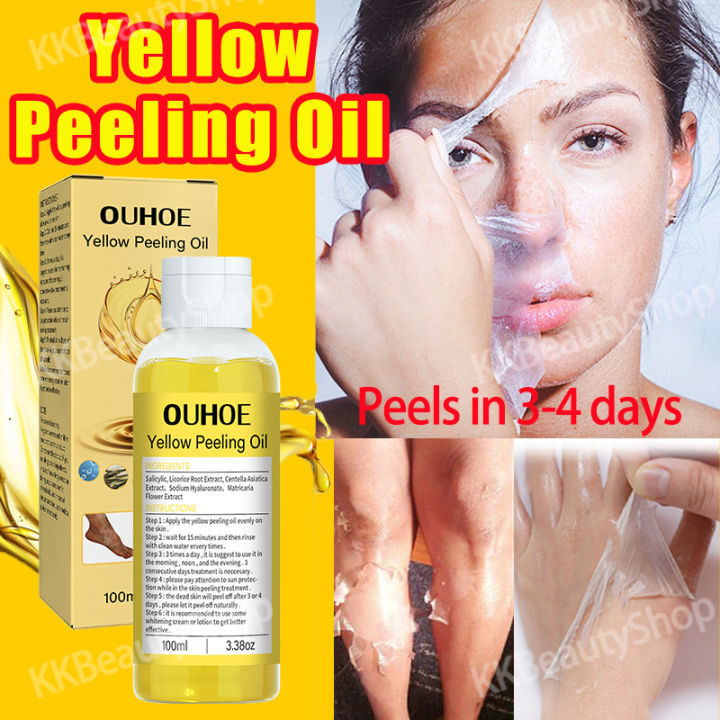 100ML Yellow Peeling Oil Skin Peeling Body Underarm Peeling Lotion