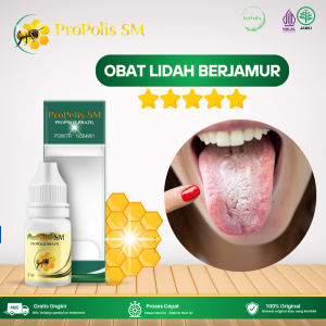 Obat Lidah Putih Berjamur Obat Lidah Putih Berjamur Obat Kandidiasis Lidah Obat Lidah Terasa Pahit Obat Lidah Luka Sariawan Dan Bau Mulut Obat Lidah Sariawan Obat Luka Lidah Dengan Propolis