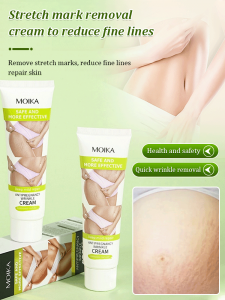 [Eliminate Stretch Marks] Body Cream for Stretch Mark Diminishment/Fine Lines Postpartum/Repair Body Care Cream