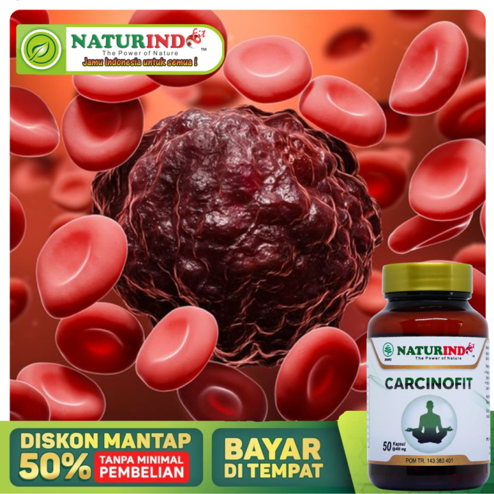 Obat Kanker Darah Paling Ampuh, Obat Kanker Darah Putih, Obat Kanker Darah Stadium 1 2 3 4, Kanker Darah Tanpa Operasi, Obat Kanker Darah Leukimia, Obat Kanker Limfoma, Obat Kanker Darah Multiple Myeloma, Obat Sel Kanker Dan Tumor - Carcinofit