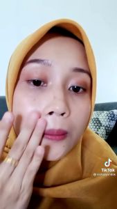 SUNSCREEN BBF/SUNSCREEN GLOW/FLEK HITAM/JERAWAT