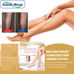 South Moon Instant Relief Varicose Vein Herbal Patch Veins Ointmnet Foot Care Repair Swelling Varicose Vasculitis Phlebitis Spider Cream Plaster Vasculitis Phlebitis Spider Cream Varicosity Angiitis Removal Herbal Medical Plaster