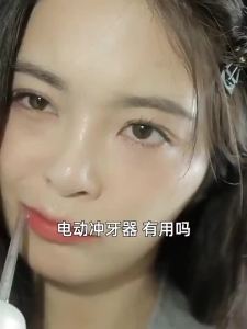 小米有品冲牙器成人便携式家用电动洁牙洗牙器水牙线口腔清洁神器