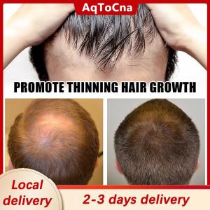 [COD] AqToCna Ship within 24 hours 1PC Derma Roller Micro Needle Hair Regrowth Anti Hair Loss Treatment for SkinBeard & Hair