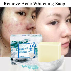 100g Original Sea Salt Soap Removal Pimple Blackhead shrink Pores Antiacne Whitening Whip Soap Goat Milk Face Wash Soap Face Wash Body Soaps Body Wash Foaming Soap Clear Mite Bath Soap Love Handmade Soap Anti Bacterial Bath Shower