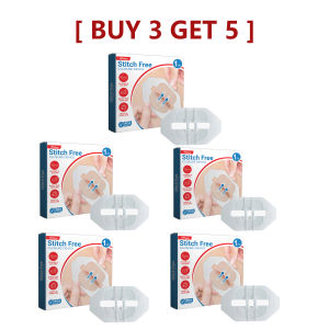 【Hot Sale】South Moon Stitch Free Closure Waterproof Adhesive Band Aid Wound Closure Emergency Bandages Outdoor Wound Adhesive Tape Disposable First Aid Wound Suture Patch Wound Band Aid(1pcs)