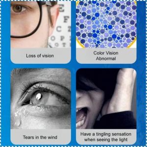 Eye drops Lutein relieves eye fatigue dryness and improves eyesight eye care