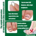Titanium Ingrown Toenail Corrector,Nail repair tools,Ingrown Toenail Treatment,Suitable for most people with ingrown toenails，Ingrown Toenail Removal Kit,- Designed for Ingrown Toenail Repair（10pcs）. 