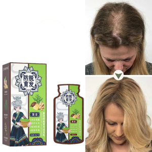 Ginger Plant Extract Anti-Hair Loss Hair Shampoo Scalp Care For All Hair Types Oil Control Hair Growth Shampoo