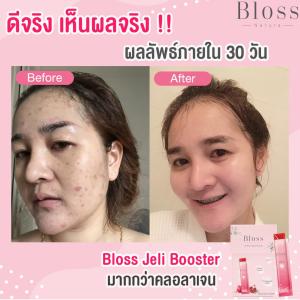 [แพ็ค3ขวด] Bloss Rose Facial Mask โรส เฟเชียล มาสก์ 30g. มาสก์บำรุงผิวข้ามคืน ผิวแข็งแรงชุ่มชื้น รูขุมขนกระชับ