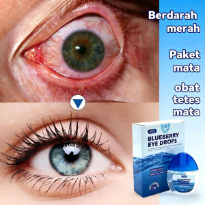 HOT Blueberry/Lutein/Herbal Eye Drops Katarak Rabun Dry Eyes Titisan Mata Relieve Fatigue Screen Use 蓝莓/叶黄素/草本眼药水 白内障近视干眼疲劳