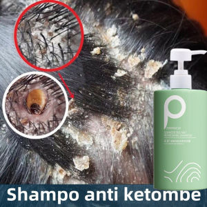 Shampo buat ketombe Shampoo penghilang ketombe anti gatal pengobatan ketombe penghilang tungau garam laut asam amino anti ketombe memperbaiki rambut kusut 500ML