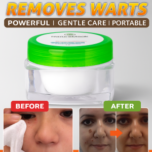 Powerful Wart Removal Cream Fast Acting For Hands Feet Eliminate Warts Skin Cream​