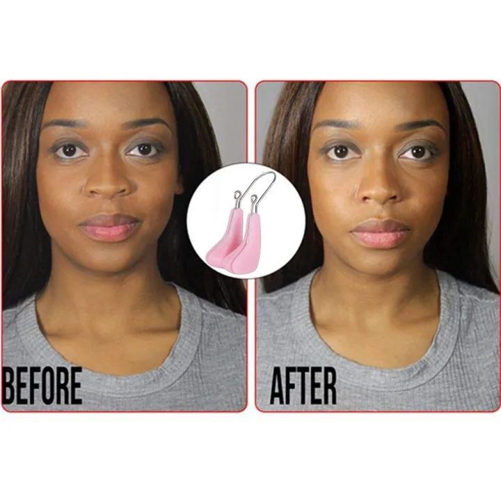 Smartconn%20Shaper%20Lifter%20Clip%20Beauty%20Up%20Lifting%20Soft%20Safety%20Silicone%20Rhinoplasty%20Bridge%20Straightener%20Corrector%20Slimming%20Device%20for%20Wide%20Crooked%20Nose%20Women%20Men%20Girls%20Ladies%20-%20Image%202