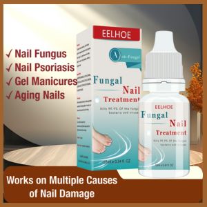 【Ready Stock】Nail Fungus Treatment Nail Repair Essence Cuticle Oil Nail Cares Nail White Lotion