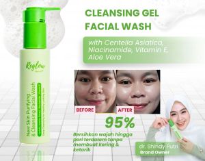 Reglow Facial Wash Glowing Sabun Cuci Muka Acne Perawatan Wajah Berjerawat Berminyak Skincare Penghilang Bekas Jerawat Flek Hitam