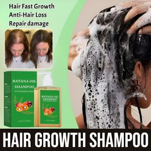 【Rapid Hair Growth In 7 Days!】Hair Growth Shampoo Natural Anti-Hair Loss Hair Growth Shampoo Anti Frizz Anti Dandruff Prevent Itchy Scalp