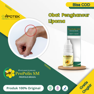 Obat Penghancur Lipoma Uci Uci Tiroid Obat Penghilang Benjolan di Tubuh - Propolis SM