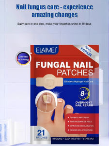 Nail Groove Nail Repair Glue Free Ingrown Nail Nail Pads Antibacterial Stickers Nail Positive