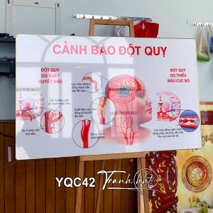 Tranh Y Tế treo tường Tranh tài liệu y tế y khoa treo tường Sách y tế Tranh Y khoa cảnh báo đột quỵ tráng gương YQC42
