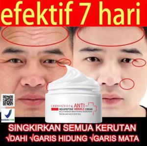 Cindynal Hexapeptide Krim Wajah Anti Kerut dan Memudarkan Keriput Black Spot Muka Dan Garis Halus Mengencangkan Kulit 70 gr Retinol Krim Pengencang Wajah Anti Penuaan Menghilangkan Memutihkan Mencerahkan Melembabkan kulit