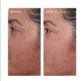 Tinh chất giảm thâm nám Murad Rapid Dark Spot Correcting Serum 30ml. 