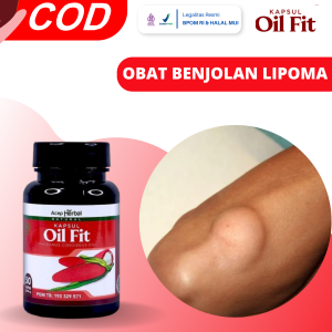 Obat Untuk Menghilangkan Benjolan Lipoma Obat Pengahancur Benjolan Di Leher Obat Benjolan Abnormal Obat Pengecil Benjolan Obat Penyakit Kelenjar Lipoma Obat Benjolan Abnormal Dengan Oil Fit