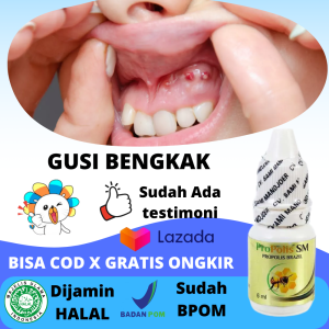 Obat Gusi Bengkak Dan Nyeri Sakit Gusi Sebelah Kanan Kiri Gusi Nyut Nyutan Gusi Bernanah / Berdarah Abses Gusi Benjolan Di Gusi Atas Bawah Obat Kumur Gusi Bengkak Anak Dan Dewasa Pengempis Gusi Bengkak Akibat Sakit Gigi Bungsu - Propolis Sm 6 Ml