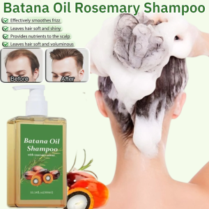 Batana Oil Rosemary Shampoo Anti-Dandruff and Oil Control Increases Hair Volume Reduce Hair Loss Shampoo