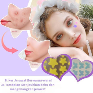 [ YM ACC ] 1 Lembar Isi 36 PCS Acne Patch / Pimple Patch - Penghilang Jerawat / Plester Jerawat