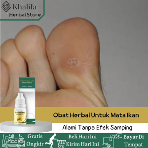 Obat Mata Ikan Obat Merontokan Mata Ikan Obat Herbal Merontokan Mata Ikan Obat Mata Ikan Alami Obat Perontok Mata Ikan Salep Mata Ikan Di Telapak Kaki Dengan Propolis SM 100%Original-Herbal Alami Tanpa Efek Samping