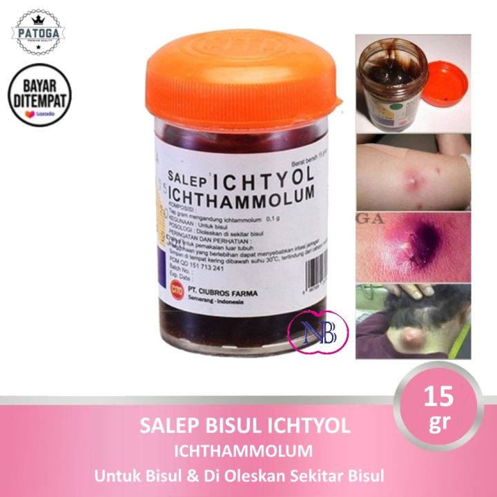 Salep Hitam ICHTYOL 15gr Obat Bisul - Patoga
